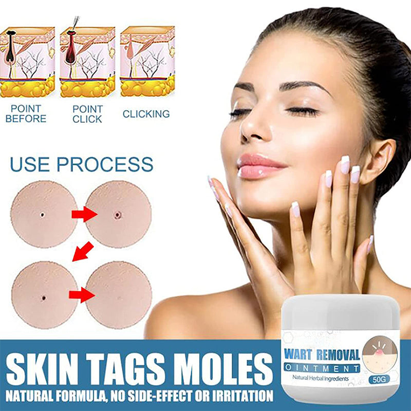 Acne Spot Treatment Creams Fast Removal