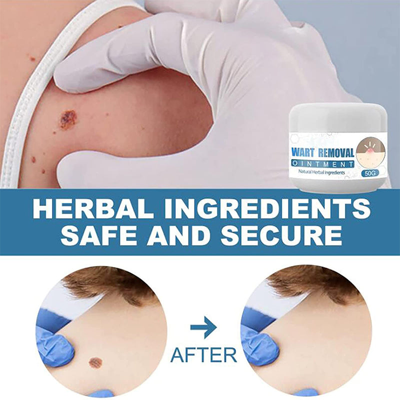 Acne Spot Treatment Creams Fast Removal