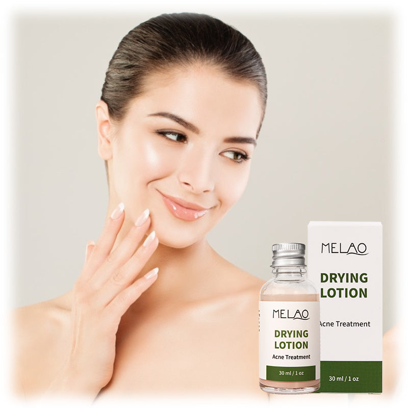 Natural Organic Acne Spot Pimple Treatment Cream