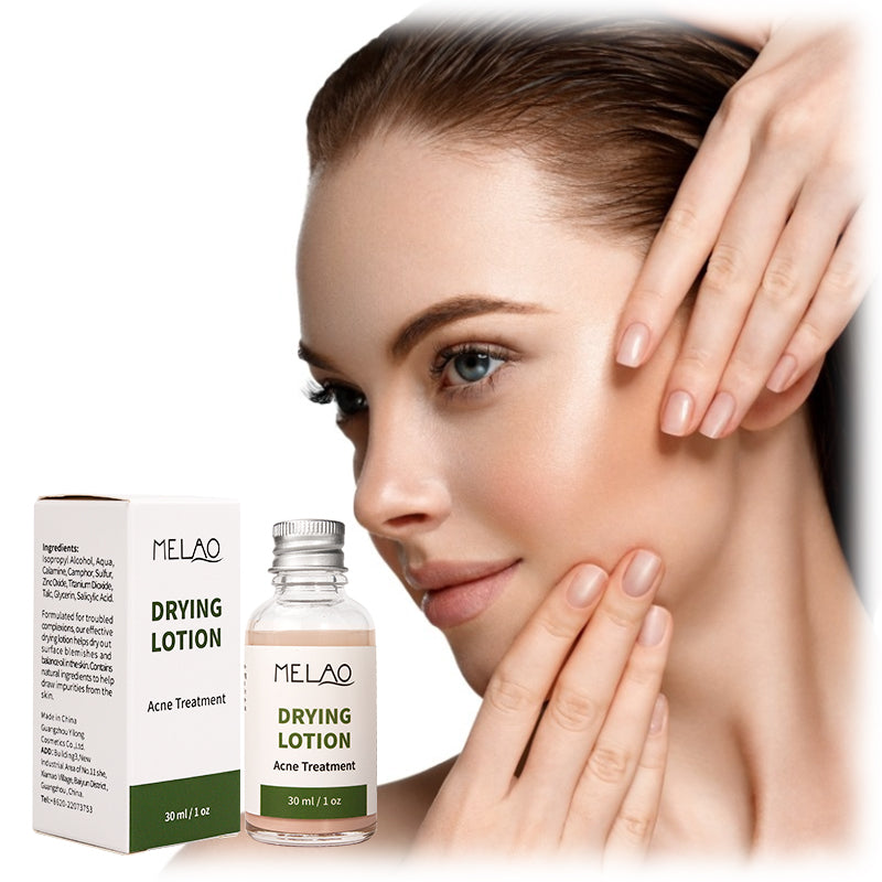 Natural Organic Acne Spot Pimple Treatment Cream