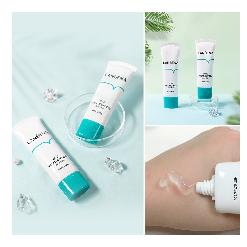 Metacnbeauty Sample  Acne Treatment Cream Remove Blackheads Pimples Gel Face Clean Effective Fade Marks Scars Refreshing Repair Damaged Skin