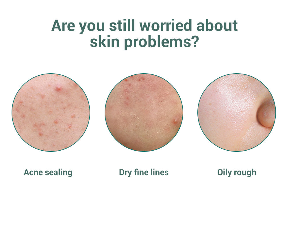 Metacnbeauty Sample Acne Treatment Toner