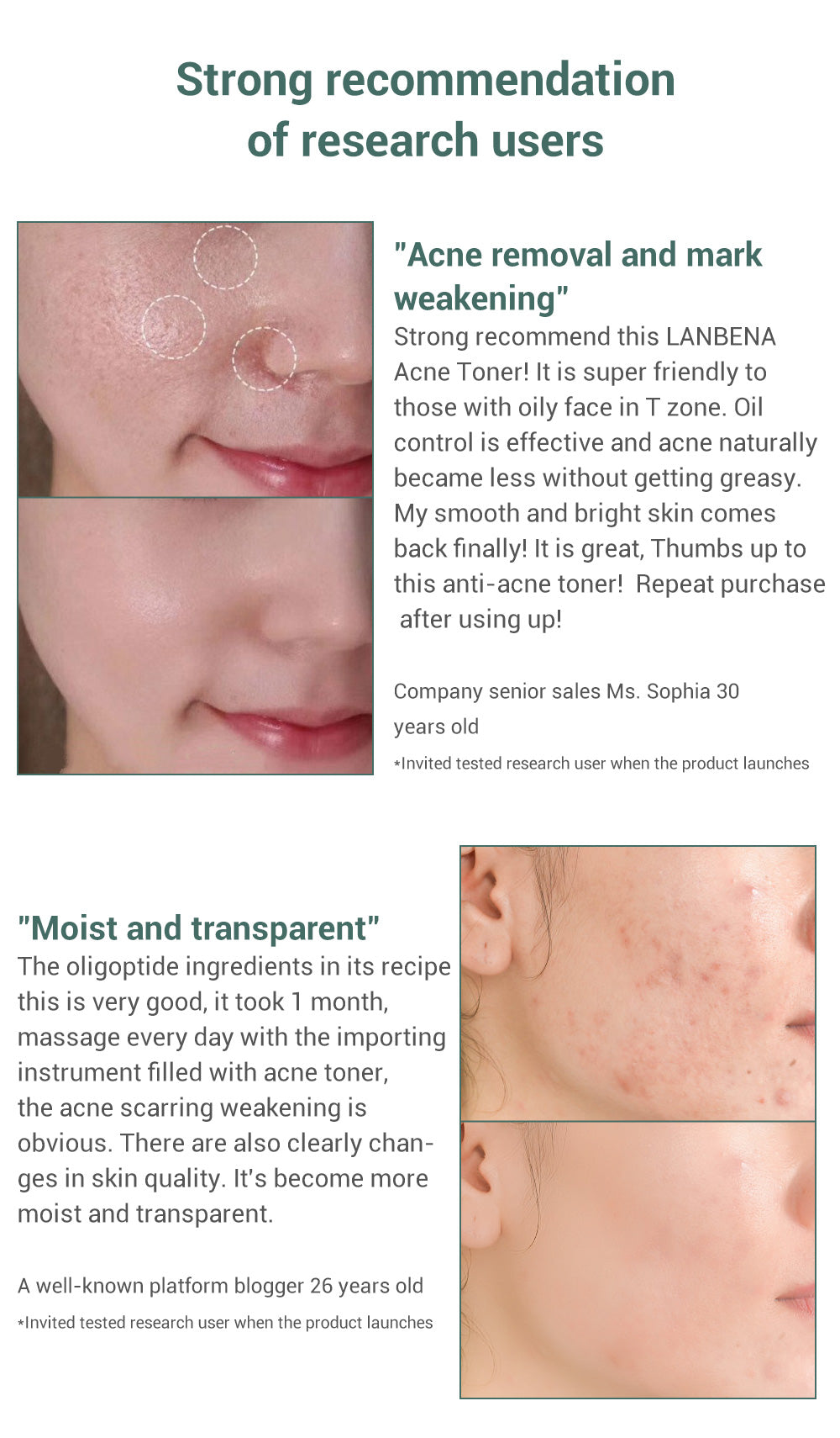 Metacnbeauty Sample Acne Treatment Toner