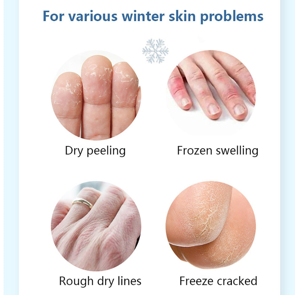 Metacnbeauty Sample Anti Crack Foot Cream