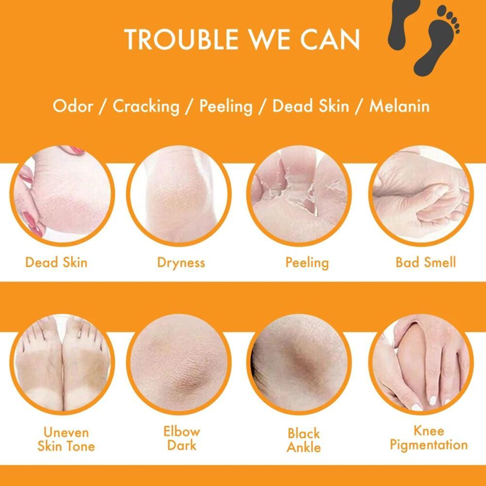 Metacnbeauty Sample 100ml Foot Peeling Spray