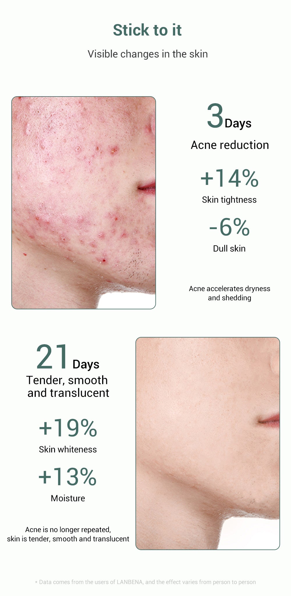 Metacnbeauty Sample Acne Treatment Serum