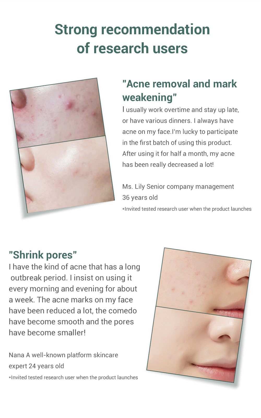 Metacnbeauty Sample Acne Treatment Serum