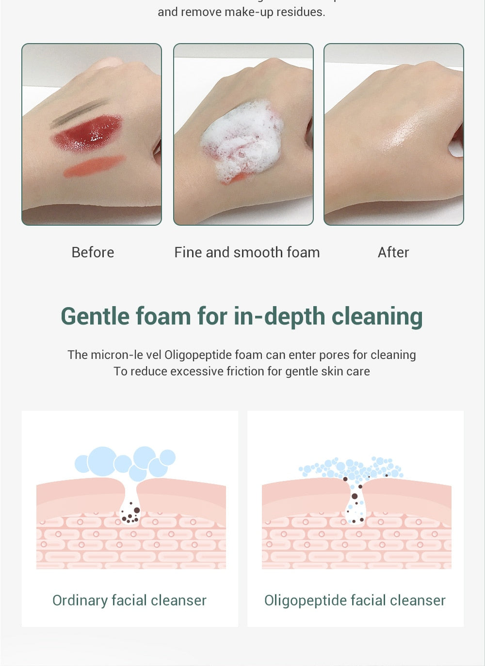 Metacnbeauty Sample  Facial Cleanser Acne Treatment